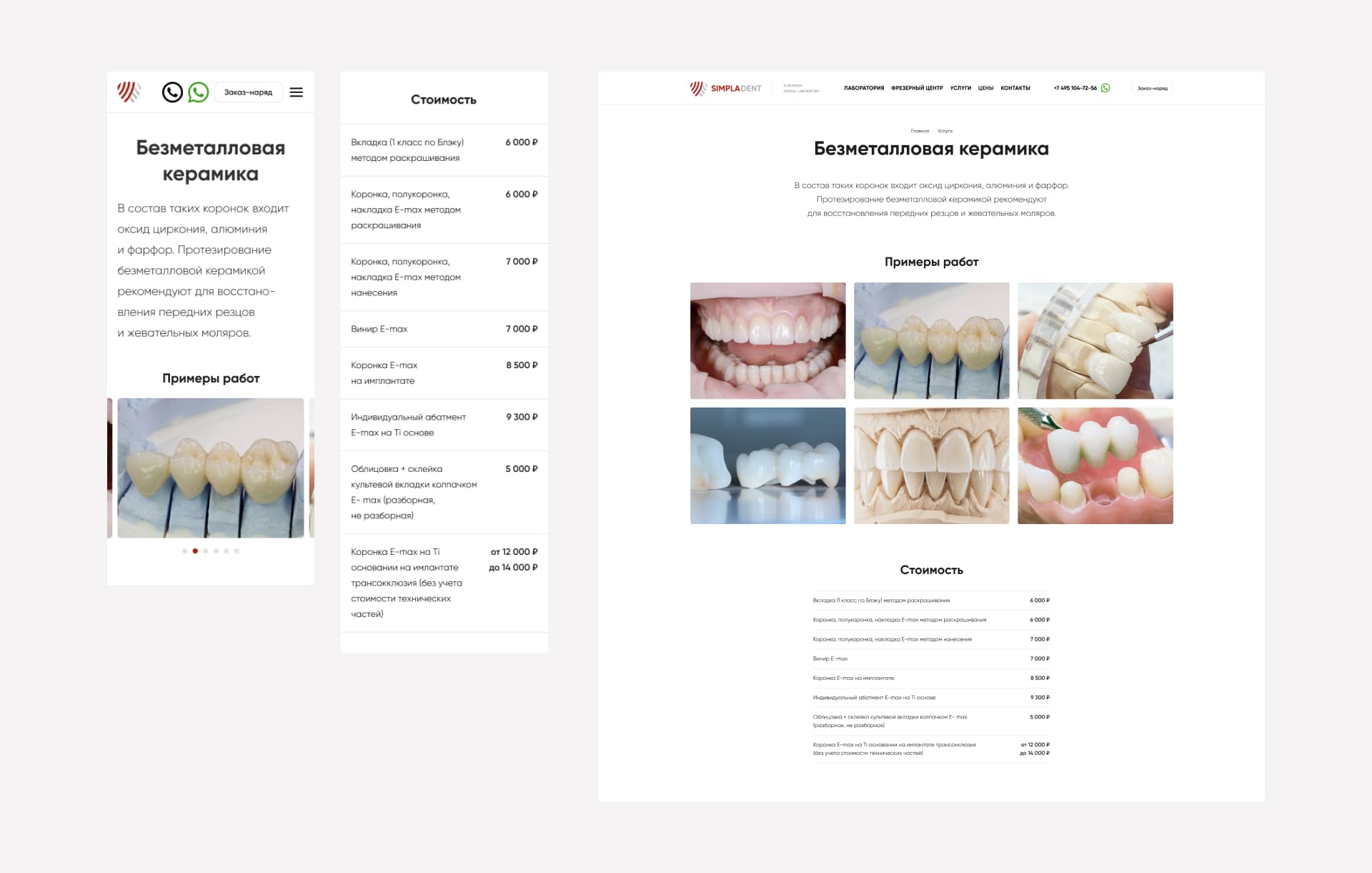 SimplaDent. Детальная страница услуги