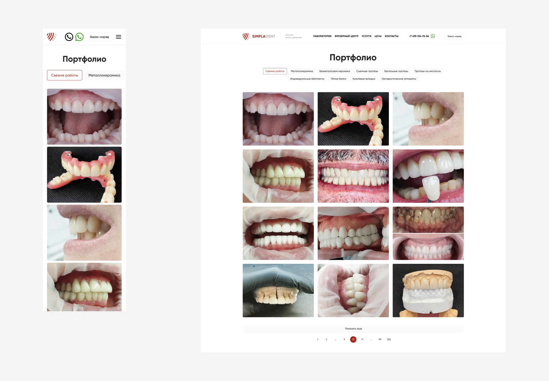 SimplaDent. Портфолио