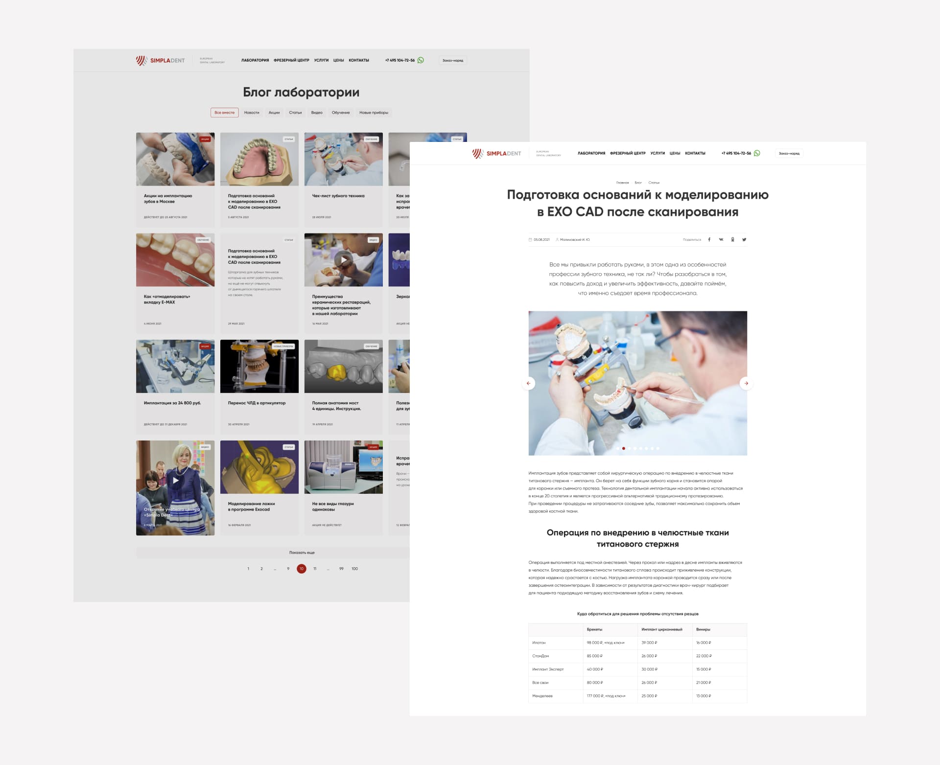 SimplaDent. Детальная страница статьи